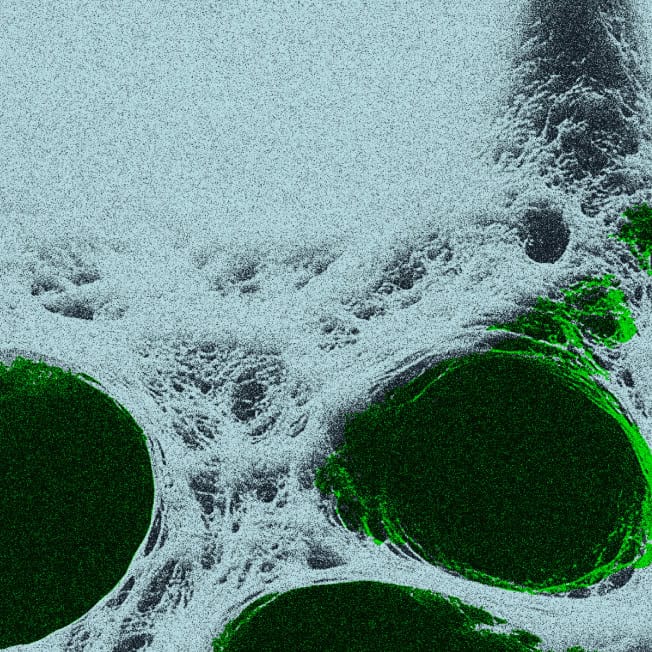 Veritas Automata IQVIA Case Study Thumbnail